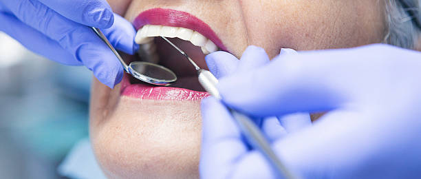 Best Emergency Wisdom Teeth Removal in Seminole, OK