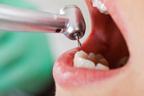 Best Emergency Tooth Extraction in Seminole, OK